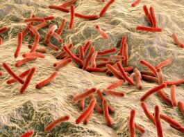 Leprosy: A Brief Overview