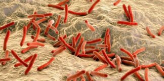 Leprosy: A Brief Overview