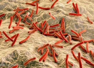 Leprosy: A Brief Overview