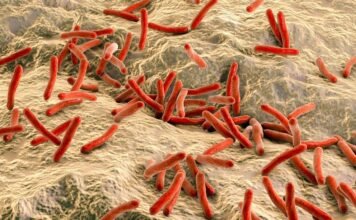 Leprosy: A Brief Overview