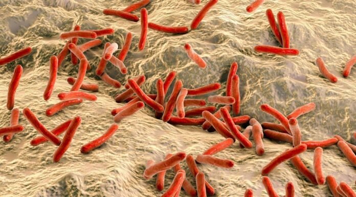 Leprosy: A Brief Overview